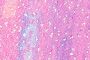 Pink Multi
